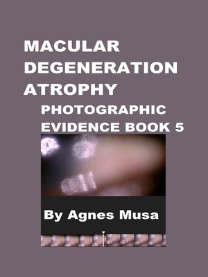 cover image of Macular Degeneration Atrophy, Photographic Evidence Book 5